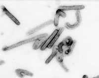 The Marburg virus, an extremely virulent disease