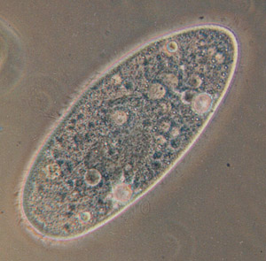 Example of a paramecium
