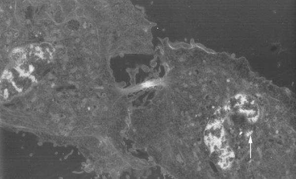 Cytokinesis electron micrograph