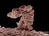 E. Coli