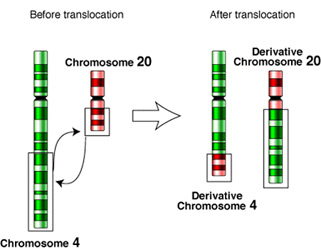Chromosome translocation