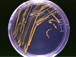 Agar plate